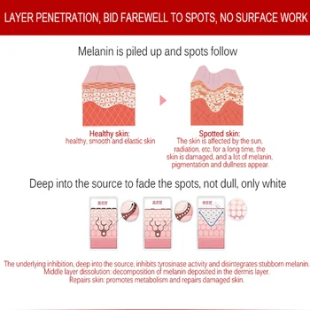 Whitening cream fregner pigmentering melasma fjernelse af hud lettelse for mørk plet manchas remover til ansigt anti aging 2 i 1