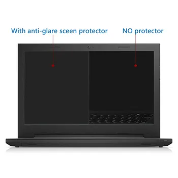 Anti Glare 15.6 Tommer Laptop Skærm Protektor til Lenovo Yoga 720 15 15.6