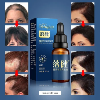 Hår Vækst Serum Essensen for Hurtig hårvækst Væsentlige Olie Anti hårtab Behandling Skæg Vækst Hår Tonic hårpleje Produkt