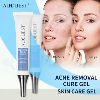 Rengøring Acne Hud Antibakteriel Acne Helende Creme Gel Ar Fjernelse Af Skin Repair Cream Comedone Bums Hudorm Behandling
