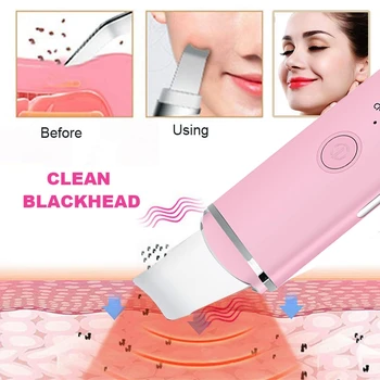 Nye Ultralyd Hud Skrubber Facial Renere Ion Acne Hudorm Remover Peeling Skovl Renere Facial Massageapparat Face Lift Maskine