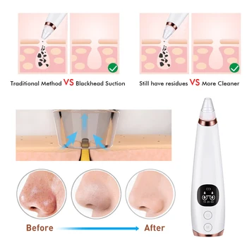 Vakuum Pore Renere Ansigt Rengøring Hudorm Acne Fjernelse Suge Black Spot Cleaner Facial Cleansing Kosmetologi Ansigt Maskine
