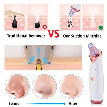 Skønhed Hudorm Remover Ansigt Deep Pore Vakuum Acne Cleaner til at Fjerne Acne Hud Tag Næse Udrensning Instrument hudpleje Værktøjer