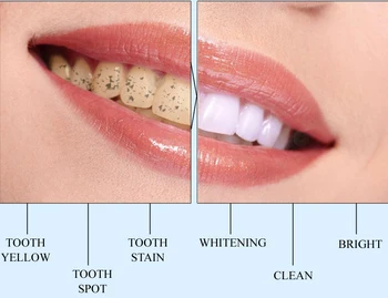 Tandblegning Tandbørste Essensen Mundhygiejne Rengøring Serum Fjerner Plak Pletter Tand Blegning Dental Værktøjer Tandpasta