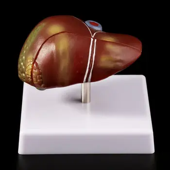 Menneskets Lever Patologisk Anatomiske Model Anatomi Skole Medicinsk Undervisning Display Værktøj, Måleudstyr