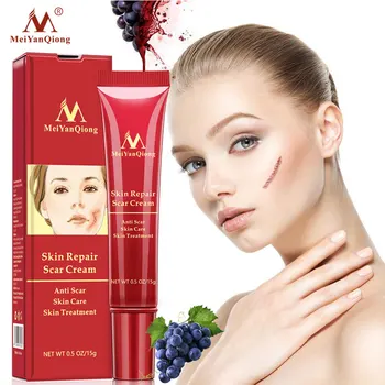 MeiYanQiong Ar Fjernelse Creme Acne Behandling Whitening Cream Fjerner Strækmærker Mørk Plet Bumser Ansigt Facial Cream Hud Pleje