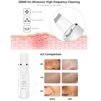 Ultralyd Facial Hud-Skrubber-Ion Dybt Ansigt Rengøring Peeling Acne Bums Remova Pore Renere Hud Pleje Enhed Hudpleje Værktøj